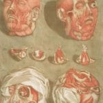 Cette Planche Represente En Detail De Grandeur Naturelle Les Muscles De Le Face.... Pl. 11 Muscle Structure Of Human Head Vintage Anatomy Illustrations