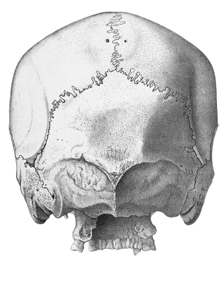 Vintage Skull Illustration Of Human Rear View