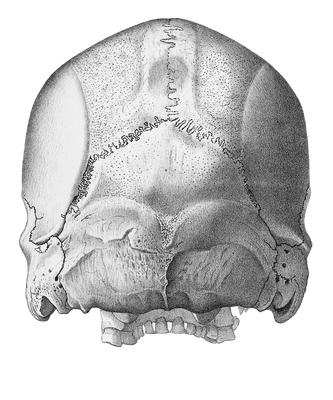 Vintage Skull Illustration Of Human Rear
